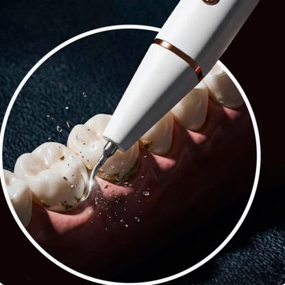 SmilePro™ – Ta Bort Tandsten & Plack Hemma
