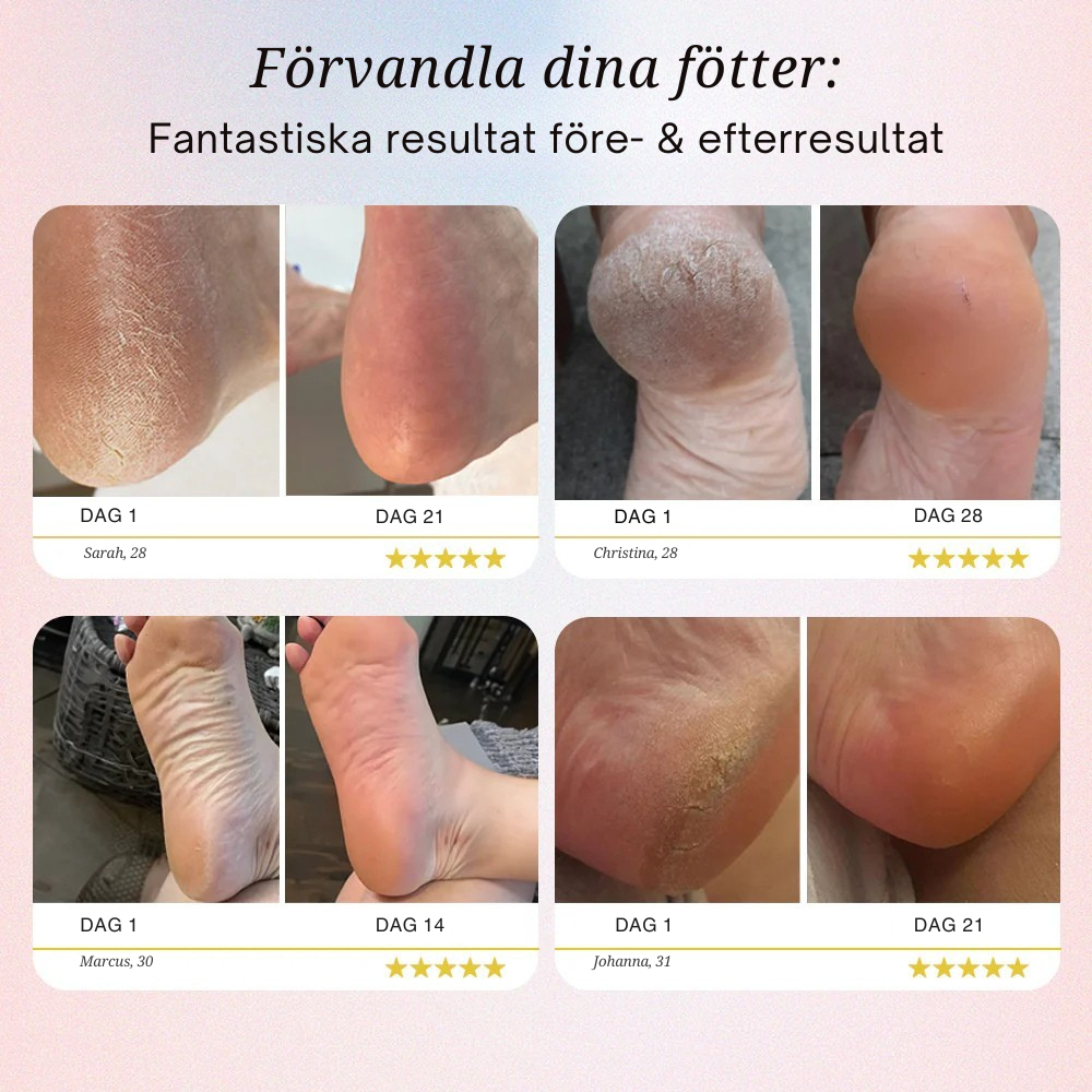 SilkStep™ – Lena Fötter På Några Minuter