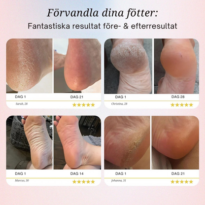 SilkStep™ – Lena Fötter På Några Minuter