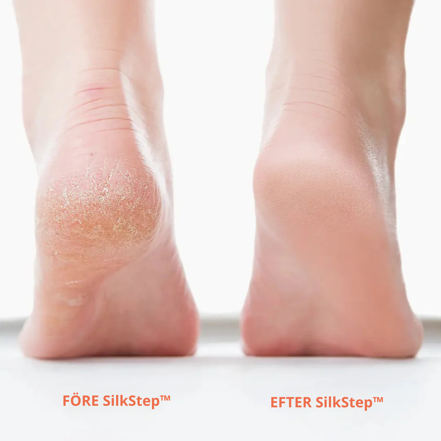 SilkStep™ – Lena Fötter På Några Minuter